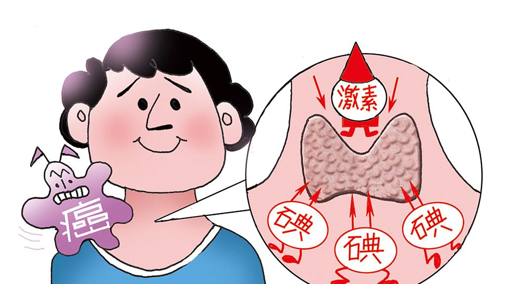 患者问：甲状腺与碘是什么关系？