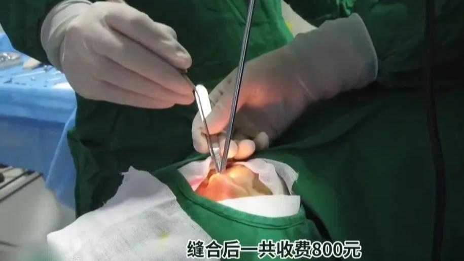 男子手指缝合手术费1830，因钱不够求第二天补齐被拒，医生：要么交钱要么拆线，结局亮了！