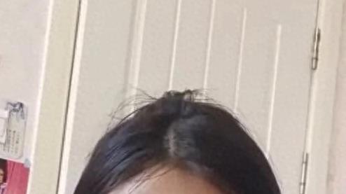 女生称艺考前十天被抱摔骨折，始作俑者赔偿两万多至今未道歉！-趣说A