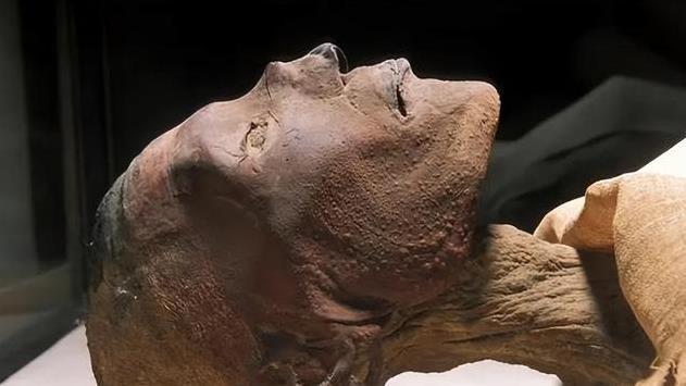 史上3大致命疫情，是怎么结束的？其中一次差点改变人类文明