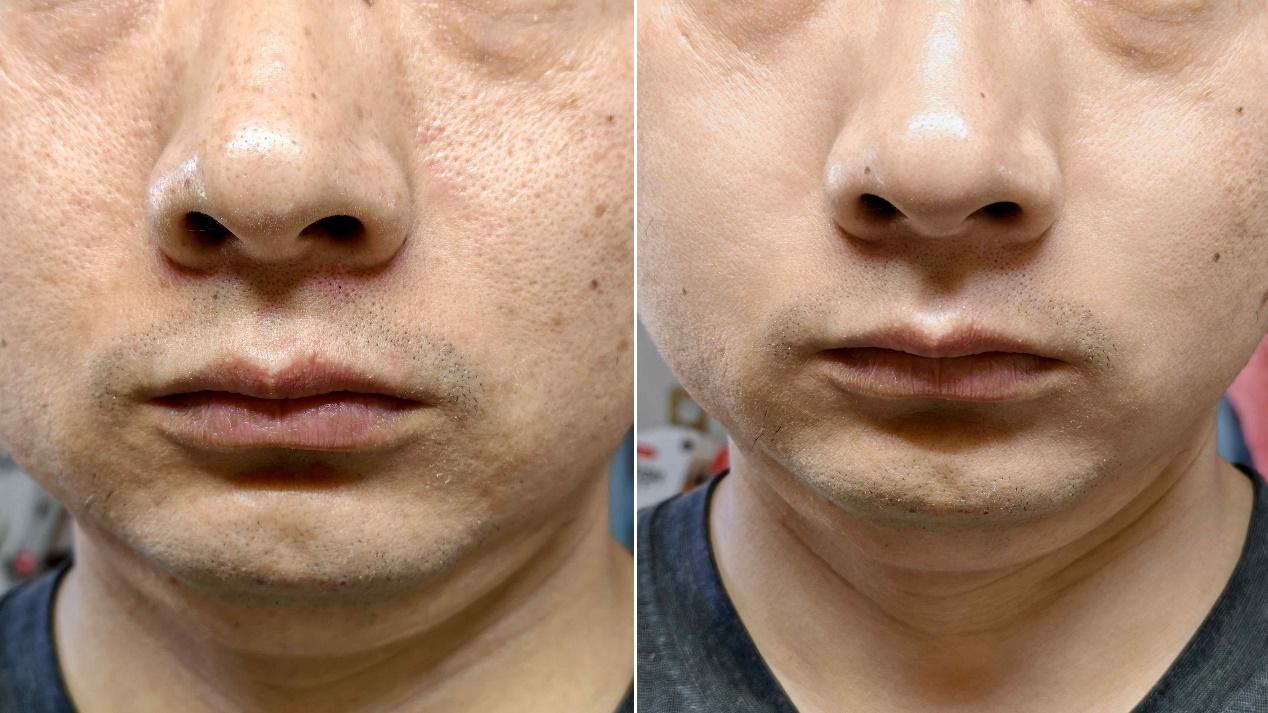 拒绝表皮清洁！赫徕洗面奶测评：渗透肌底净化毒素 + 抗衰养肤