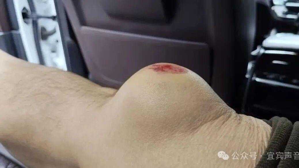 谁来保障市民回家“最后一百米”畅通？