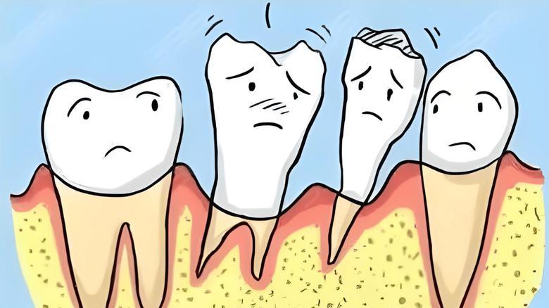 刷牙牙龈出血？可能牙周炎，早期信号别忽视，别等牙齿脱落再去治