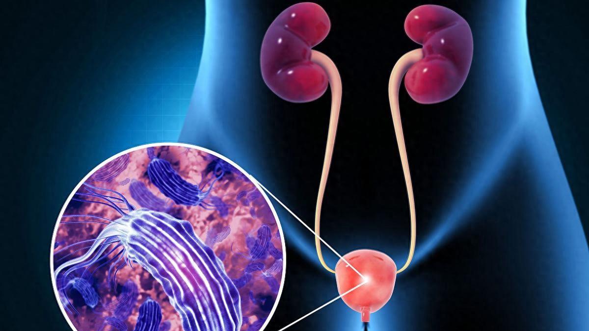 你的小便正发出求救信号，这些症状不是小毛病，可能泌尿系统感染