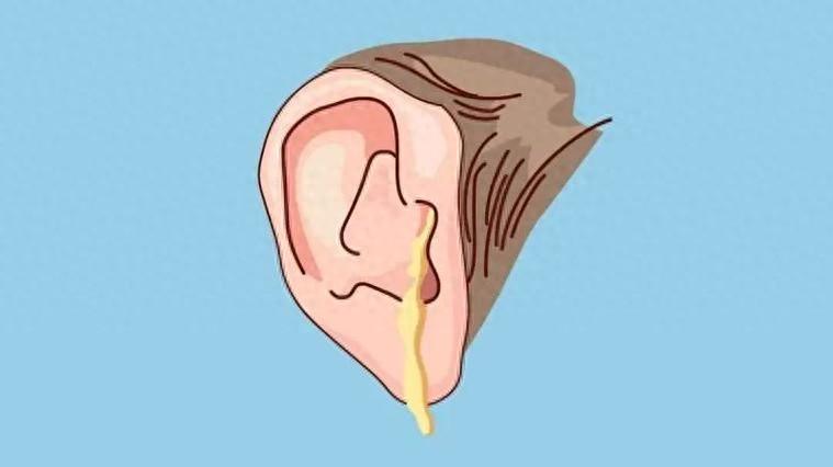 中耳炎儿童更容易中招，3岁前家长做好预防，出现4类症状要就医