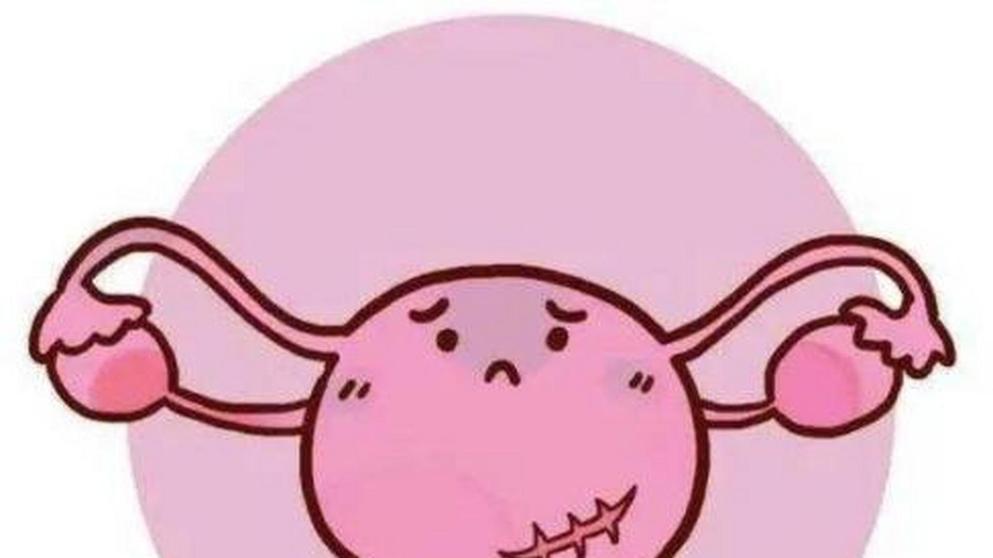 子宫肌瘤=癌变？必须切子宫？错！别再被这些误区误导