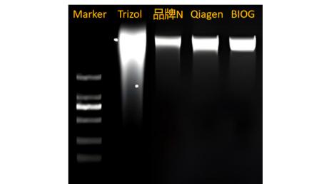 粪便DNA提取方法比较与分析