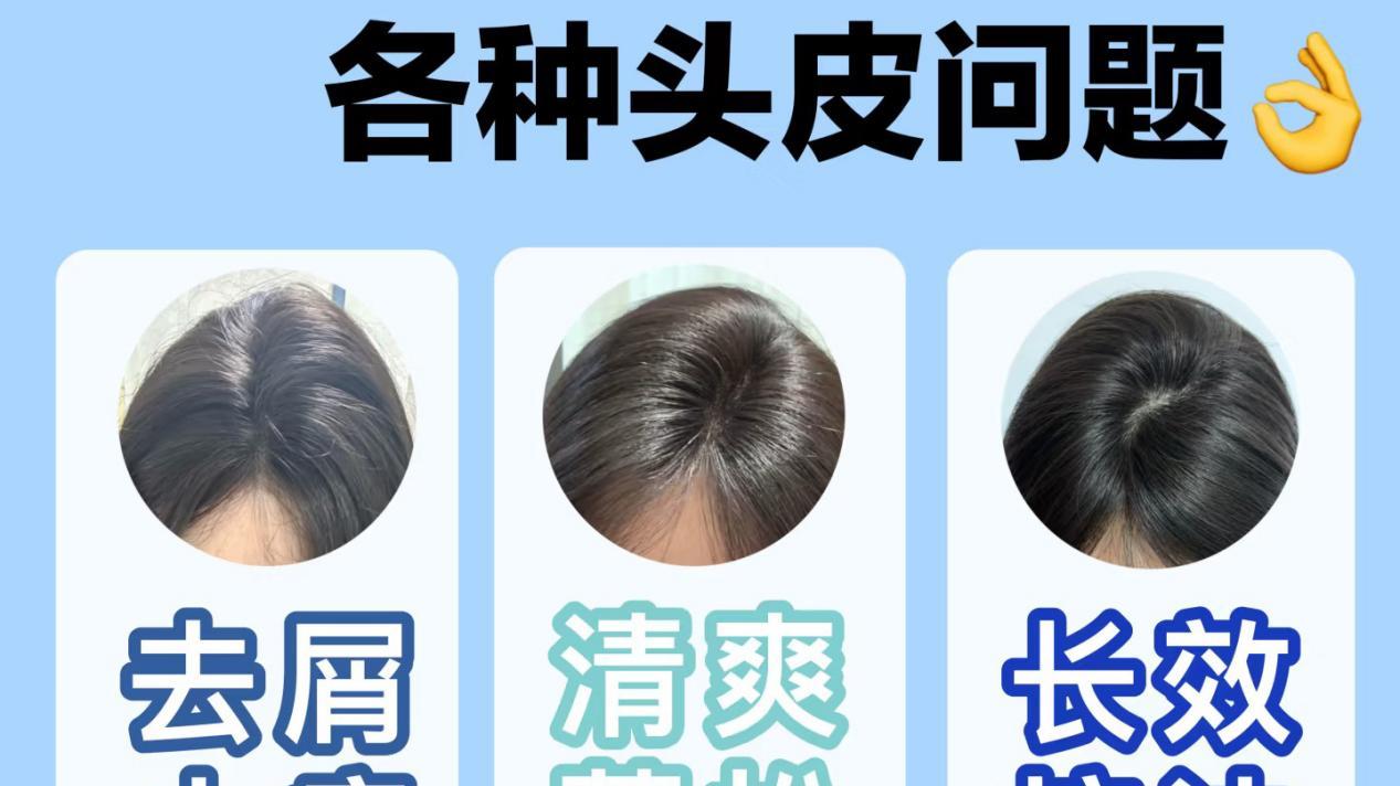 2026控油洗发水深度解析与权威推荐：控油蓬松留香全家爱用！