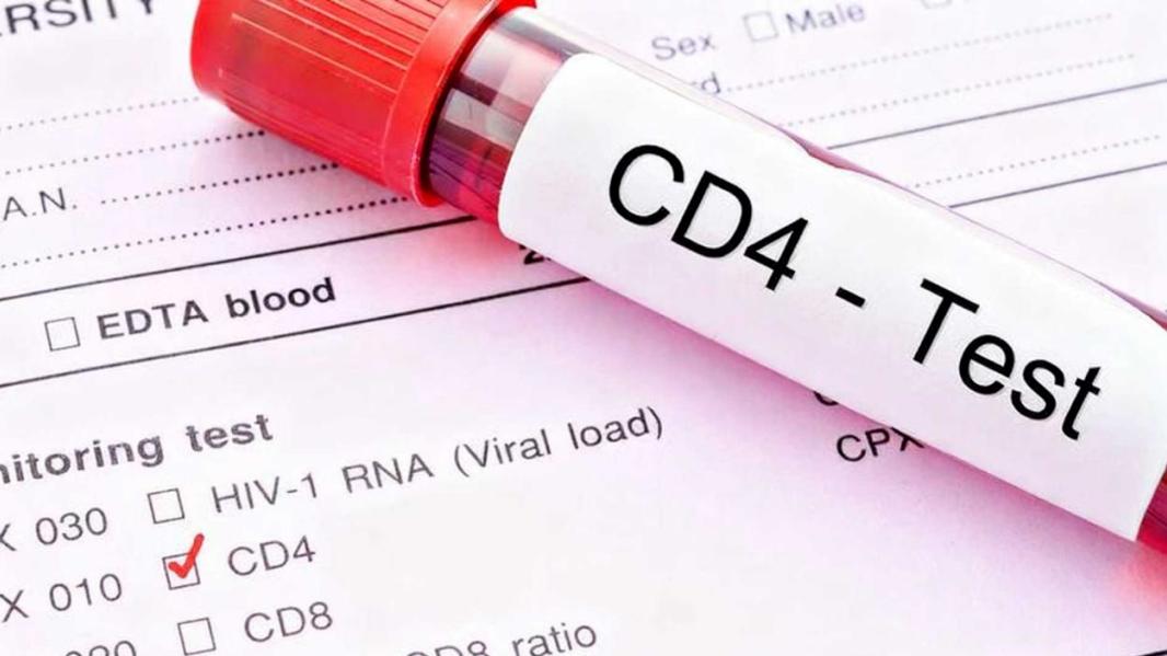 1分钟说清楚，什么是病毒载量和CD4？艾滋病毒感染者必看的两大“健康仪表盘”