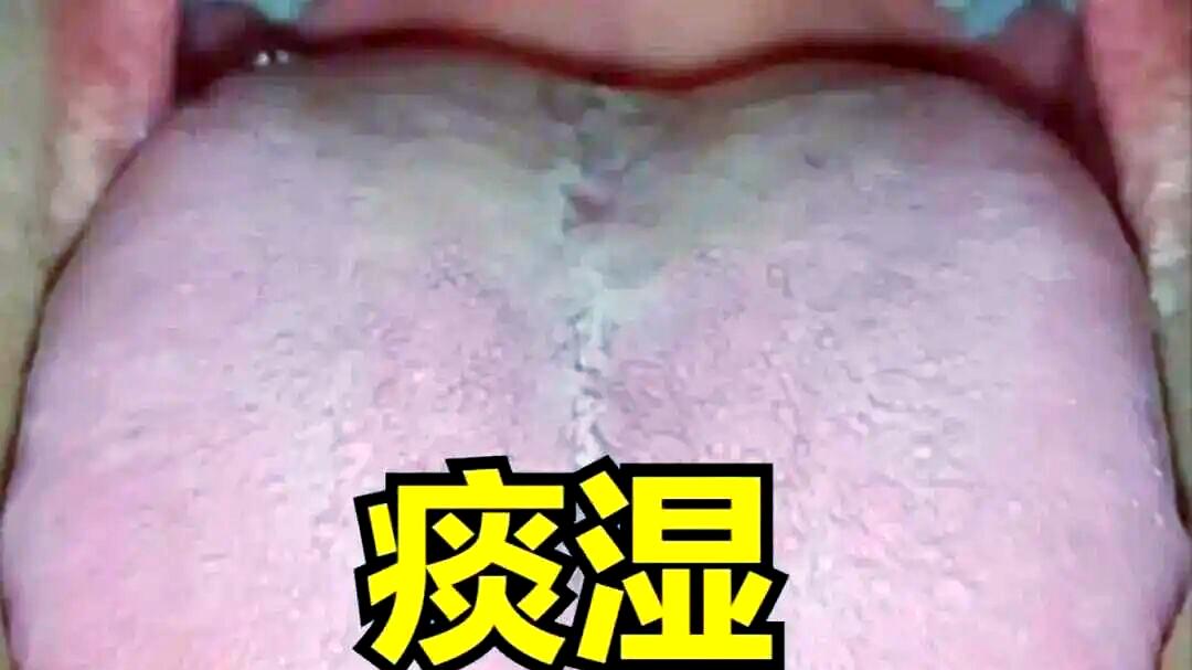 脂肪瘤，咳嗽痰多，治脾治肺都没用？这种情况得调肾了
