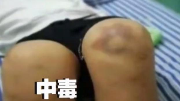 11口之家怪病缠身，三年隐秘投毒，真相背后令人心寒