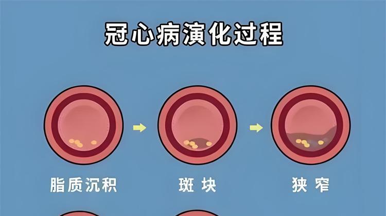 冬季户外作业防护！硝酸甘油为环卫工人、电力工人筑牢健康防线