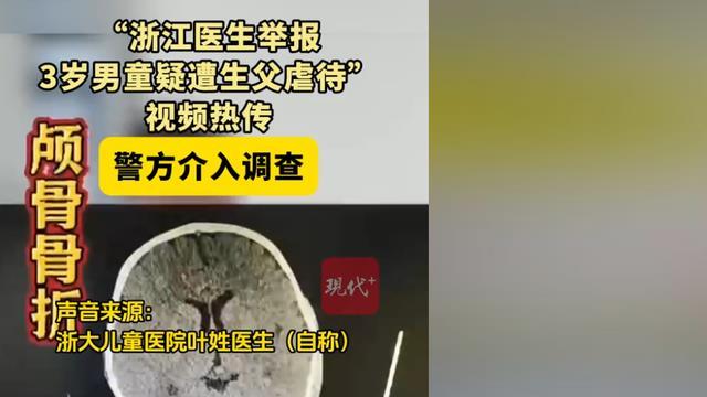 颅内出血、骨头外露， 医院举报3岁男孩疑遭家人“教育”全身重伤