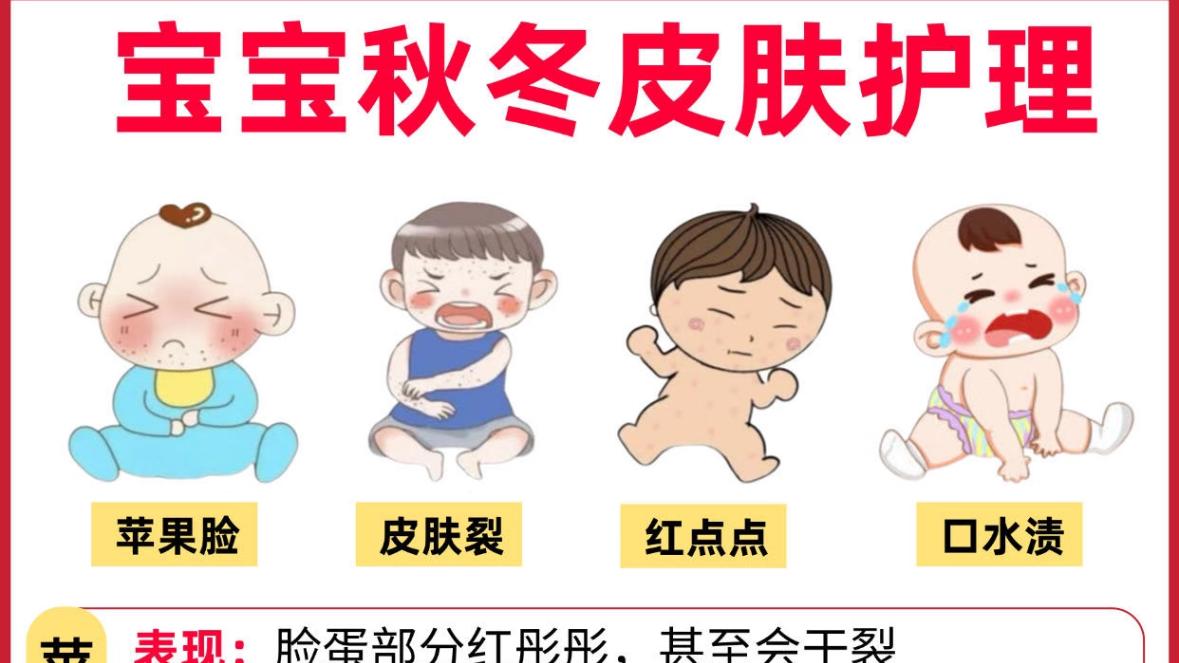 宝宝秋冬皮肤怎么护理？看这篇就够了