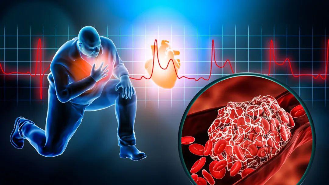 苦苦找了45年，依然只有纳豆激酶才是对抗心脑血管疾病的最优解