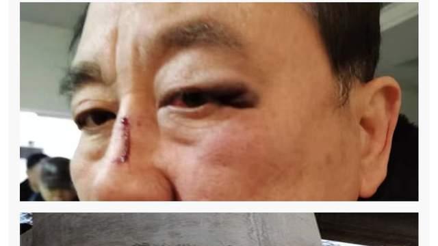 太原康养公寓老板捅小舅子，同室操戈重伤不治惹祸，亲戚变仇人内幕蹊跷