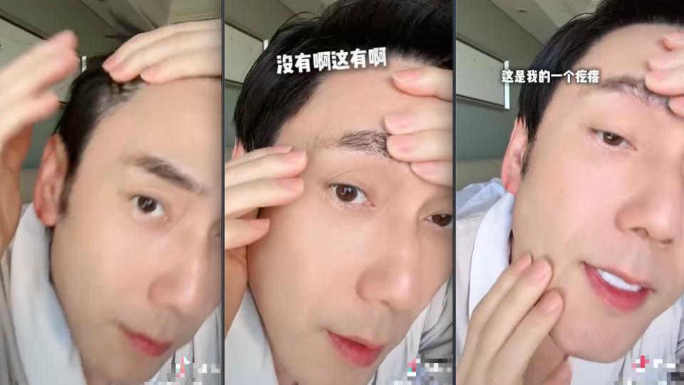 55岁林依轮年轻到不可置信，遭上万人质疑整容，状态真的很夸张