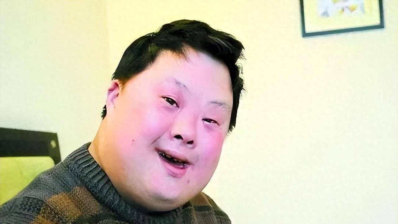回顾：还记得天才指挥家舟舟吗？智商只有三岁，如今过得怎样？