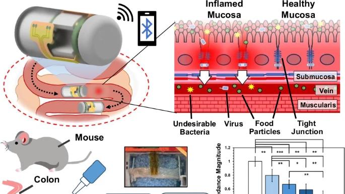 新型胶囊来助力！可无线监测上皮屏障
