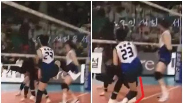 女排国家队主力 扣球落地 膝盖异常扭曲90度 当场无法站立 紧急送医