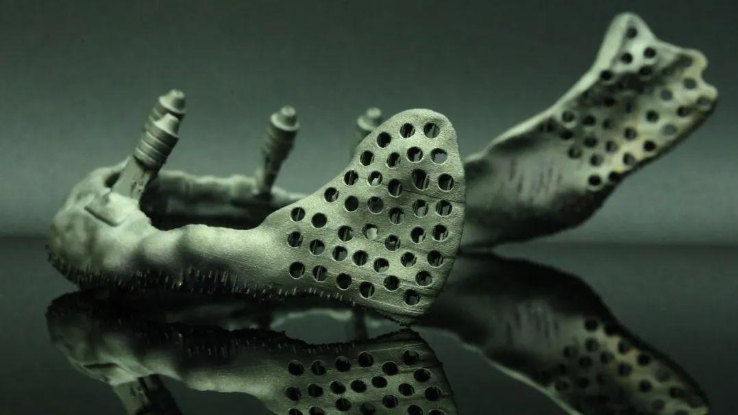 金属3D打印：打破口腔医疗传统枷锁的革新力量
