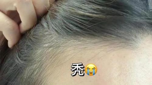 防脱发生发增发密发哪个牌子好？不踩雷，四款高效产品推荐