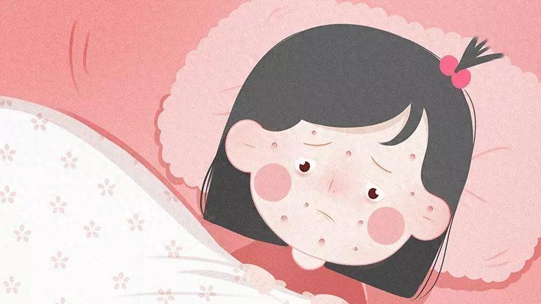 一到冬季，儿童水痘高发期，父母做好这3点预防