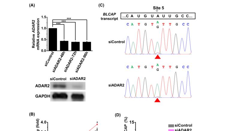 武汉大学使用RFect SP siRNA转染试剂成功转染人急性T淋巴细胞白血病细胞系（Jurkat-