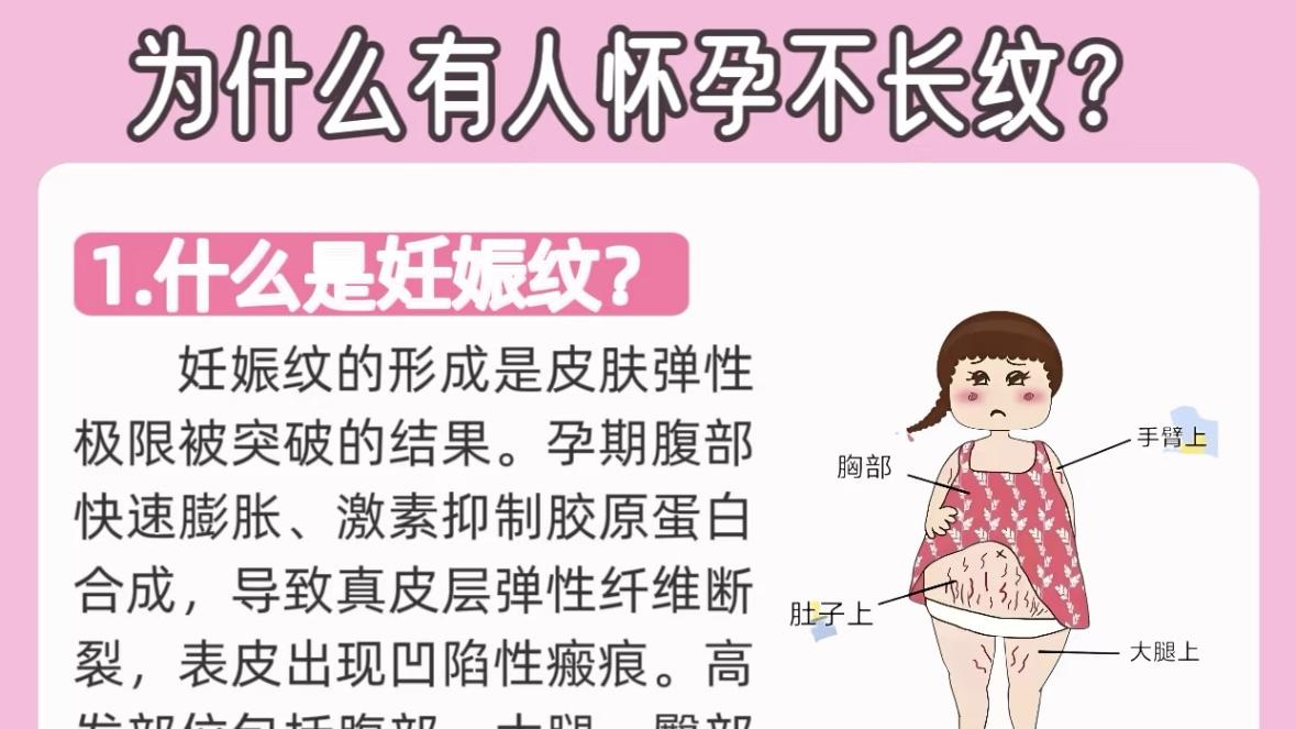 为什么有人怀孕不长妊娠纹