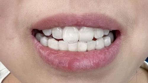 【成分党深扒】“诺维信蛋白酶”？为何它能让雅克菱清洁力翻倍？