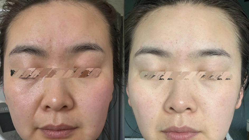 50岁后，认真护肤和懒得护肤的人，差距到底有多大？