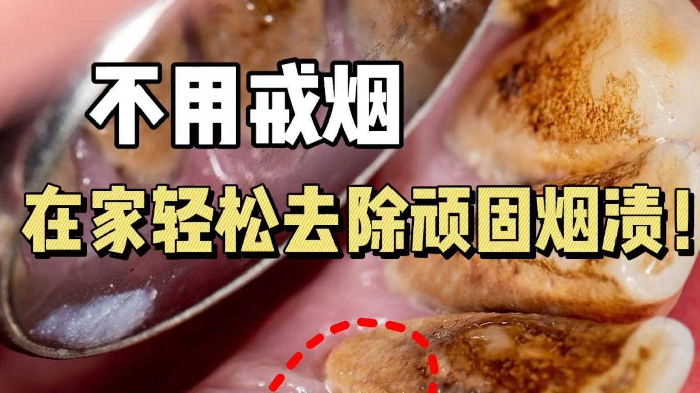 烟渍茶渍牙一刷就白？老烟民随便支你几招，在家轻松搞定发黑脏牙！