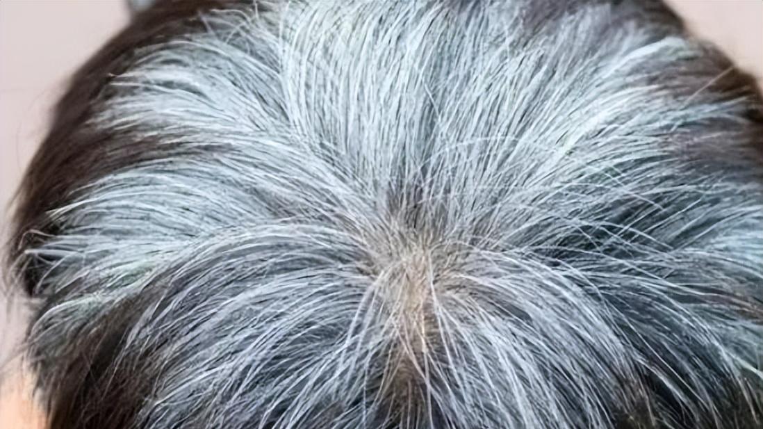 白发越多，肾精越亏！4个中成药，补精血，乌白发，告别染发剂！