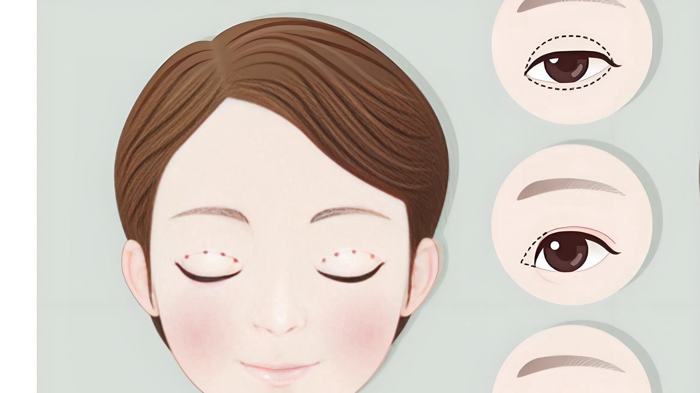 术后“玻璃心”期：伊美时代如何给我“看得见”的安全感