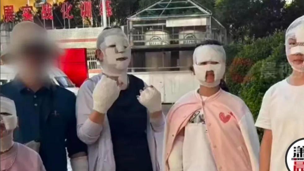 摊上事！后槽牙估计都要咬碎，五一用卡式炉炸成木乃伊的人出现了