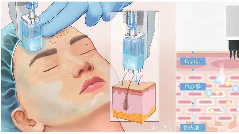 我们离真正的变美自由，有多远？