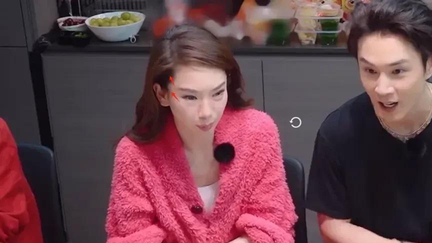 医美后遗症明星也躲不过



医美能对抗衰老吗？我看未必！别不信，娱乐圈那些“冻