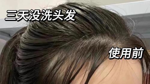 控油去屑洗发水品牌大比拼！2025 深度测评，这几款终结头油危机