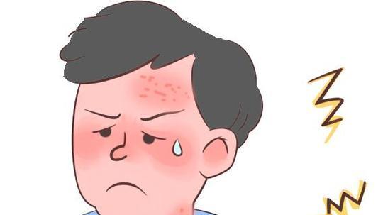 嘴角起泡不是上火，90%单纯疱疹作祟！及时治疗，防止传染给家人