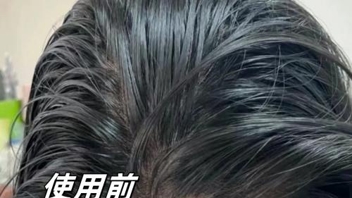 告别油雪花！2025秋冬最新控油去屑洗发水种草清单