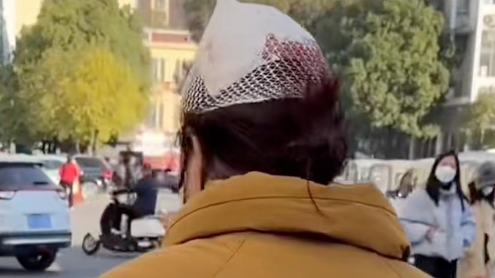 后脑勺缝了9针！女生这些场景戴它，等于顶了个“凶器”？