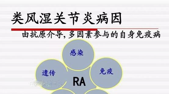 托法替尼对类风湿的真实效果分享，先查查你有没有这个基因