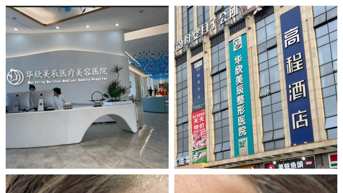 成都华*美辰医美术后 “变鬼样”？消费者身心受创盼修复