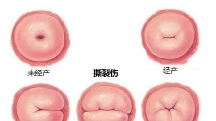 现代医学的宫颈锥切简直就是坑人的手术