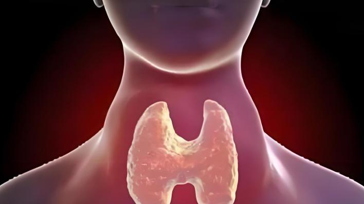 干细胞疗法：桥本甲状腺炎治疗的新曙光