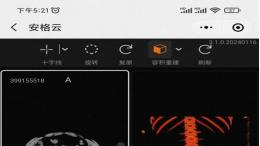 安格云影像助推医学影像检查互认共享