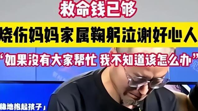 绍兴烧伤妈妈揭开纱布露面，元旦录视频谢网友，容貌较之前变化大