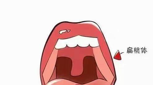 孩子扁桃体又发炎了？当心这些“健康隐患”！