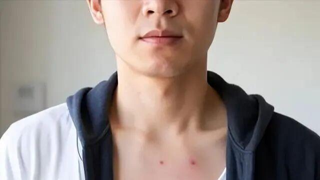 专家研究577名艾滋病感染者，发现艾规律：易感染的人，都有5点