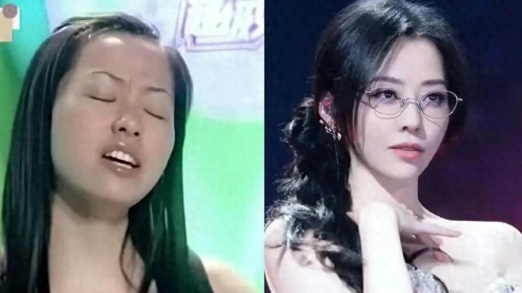 张靓颖2005和2025对比，丑小鸭蜕变白天鹅！张靓颖用20年打脸整容传闻